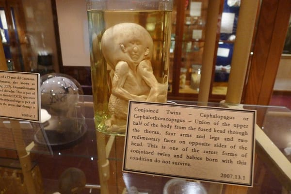 Will Mutter Museum return to its wonderful, horrible ways?